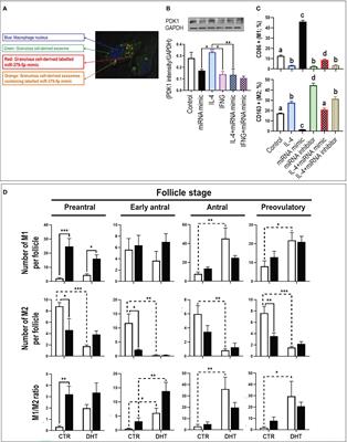 Granulosa cell-derived miR-379-5p regulates macrophage polarization in polycystic ovarian syndrome